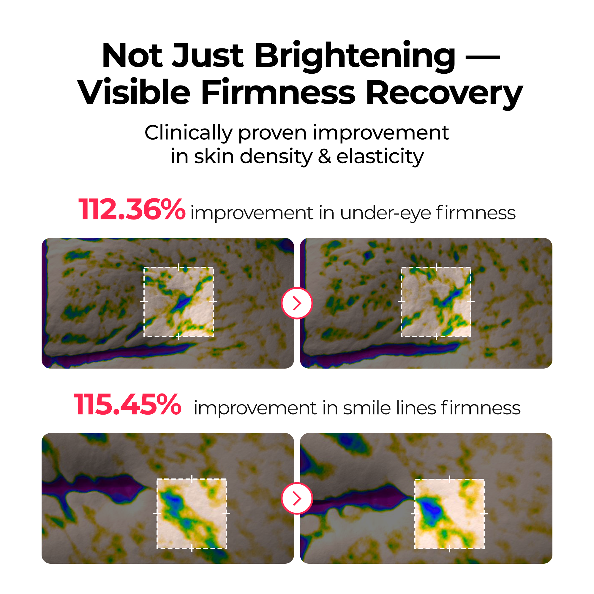 TX Astaxanthin Dark Spot Care Hydrogel Mask 4EA - image 4